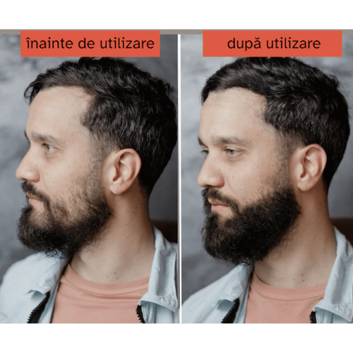 Extra-Hair inainet si dupa utilizare (2)