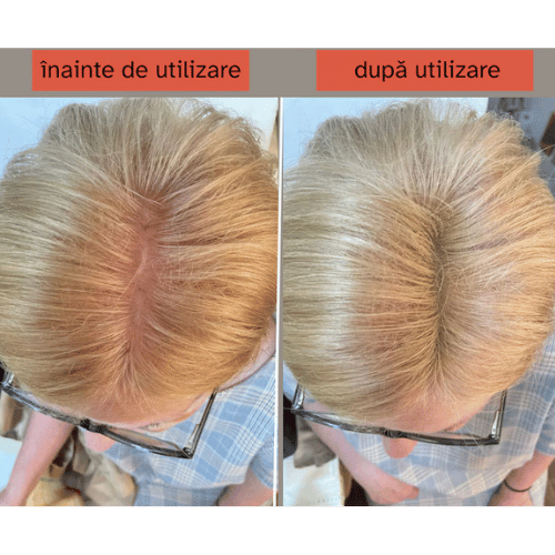 Extra-Hair inainet si dupa utilizare (3)