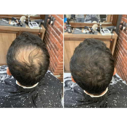 Extra-Hair inainet si dupa utilizare